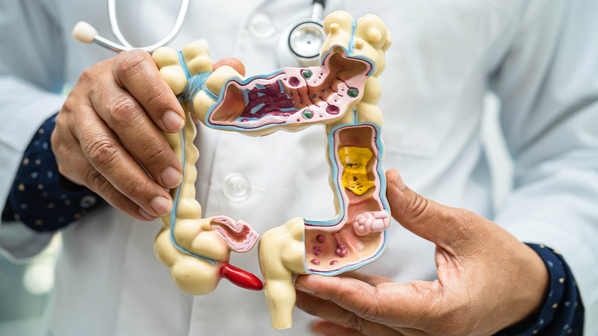 a doctor holding a digestive tract model to show digestive health